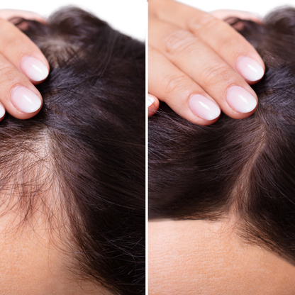 Women's Elite Regrowth Capsules