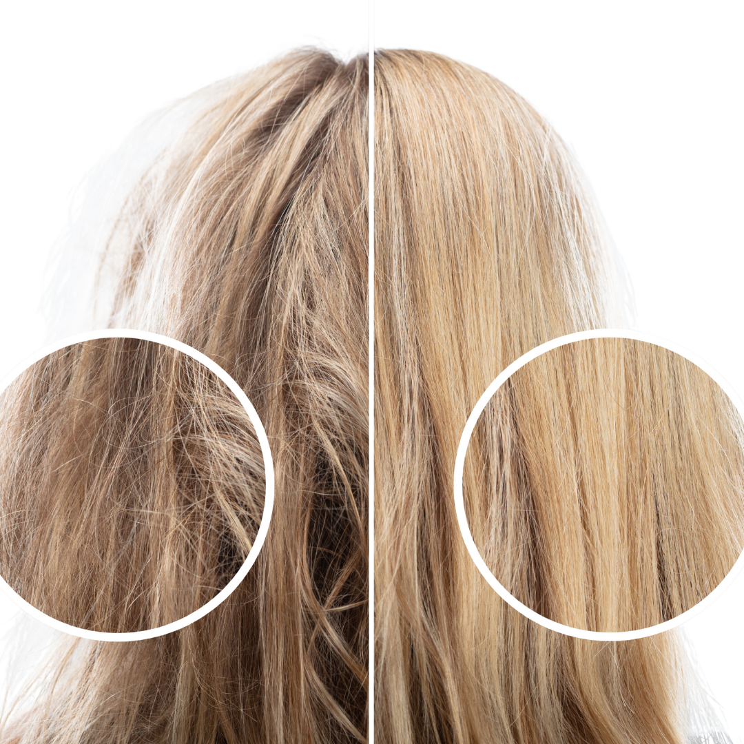 RootRenew Finasteride – Men’s Growth