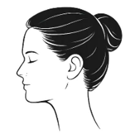 Female hair loss pattern: moderate